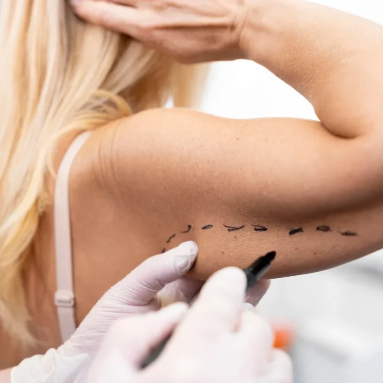 home-1-8-liposuction.webp